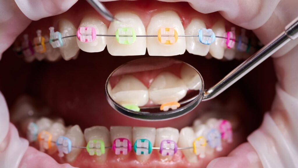 Orthodontist in Sharjah